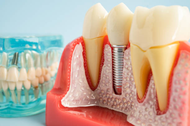 Best Tooth Extraction  in Ruidoso Downs, NM